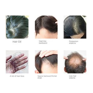 Helmet Laser Cap For Hair Growth - Beautyic.co.uk