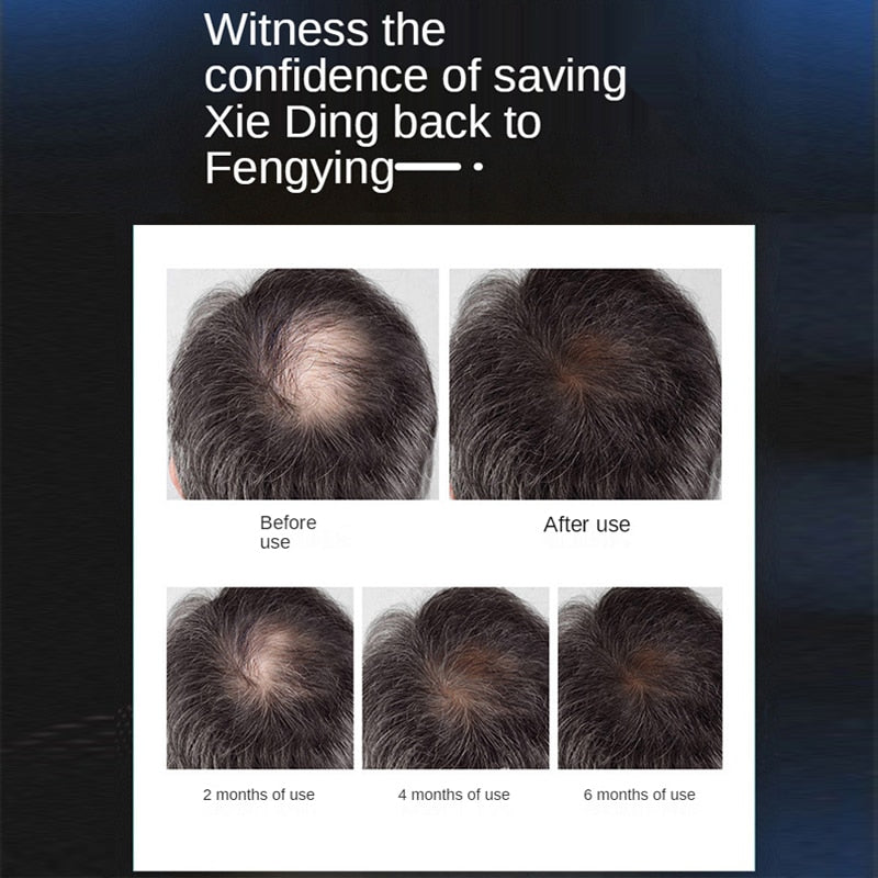 Helmet Laser Cap For Hair Growth - Beautyic.co.uk