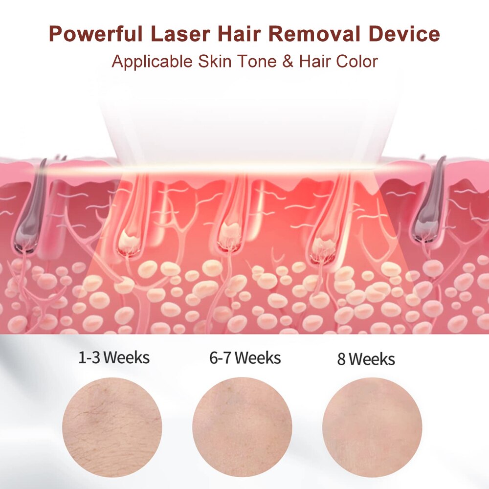 Hair Removal IPL Laser Epilator Facial Cleanser - Beautyic.co.uk