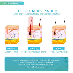 Hair Regrowth Laser Helmet With LED Lights - Beautyic.co.uk