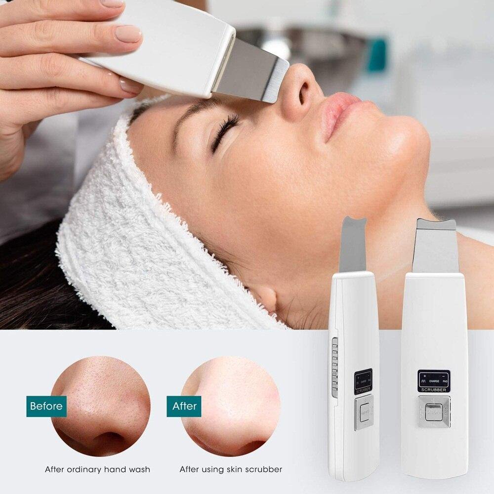 Ultrasonic Skin & Face Scrubber - Beautyic.co.uk