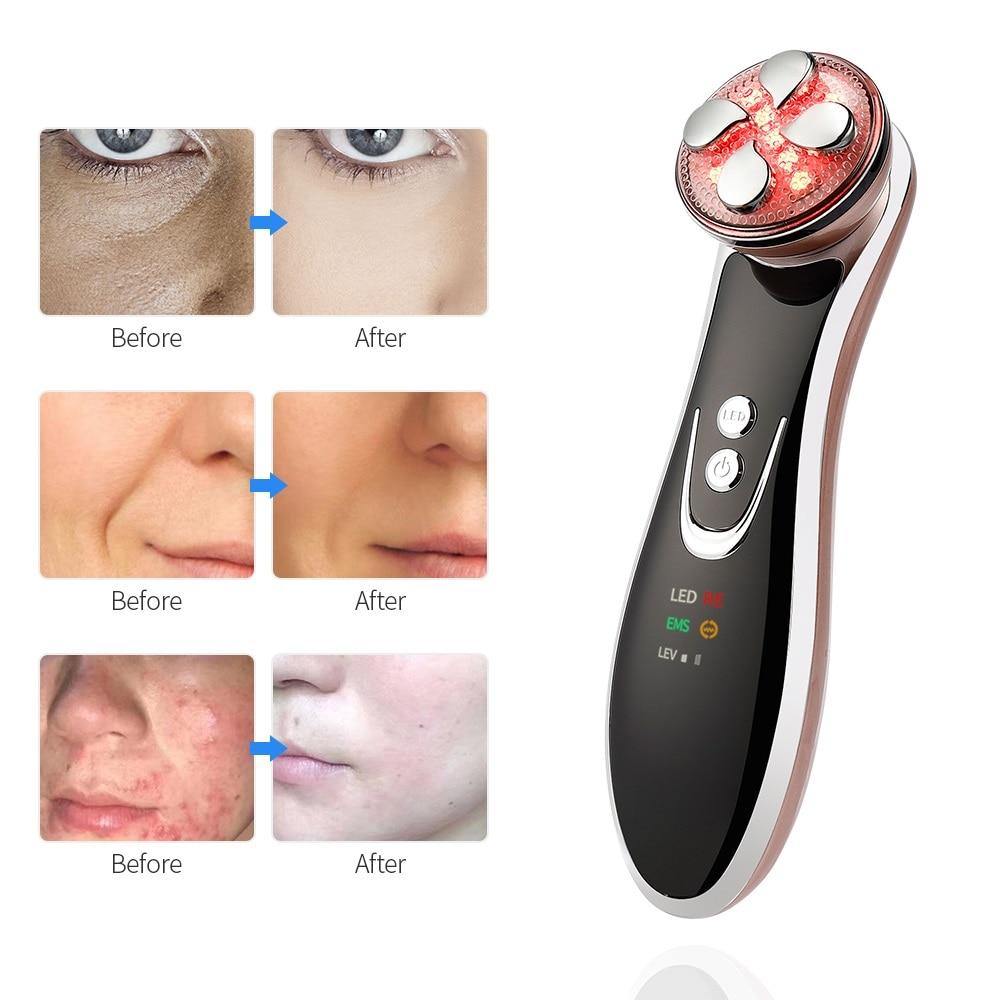 5 In1 RF EMS Radio Frequency LED Photon Skin Lifting Device - Beautyic.co.uk