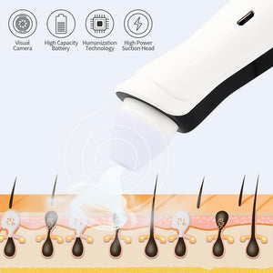 Visual Blackhead Pore Vacuum Remover Cleaner With Wifi Camera - Beautyic.co.uk