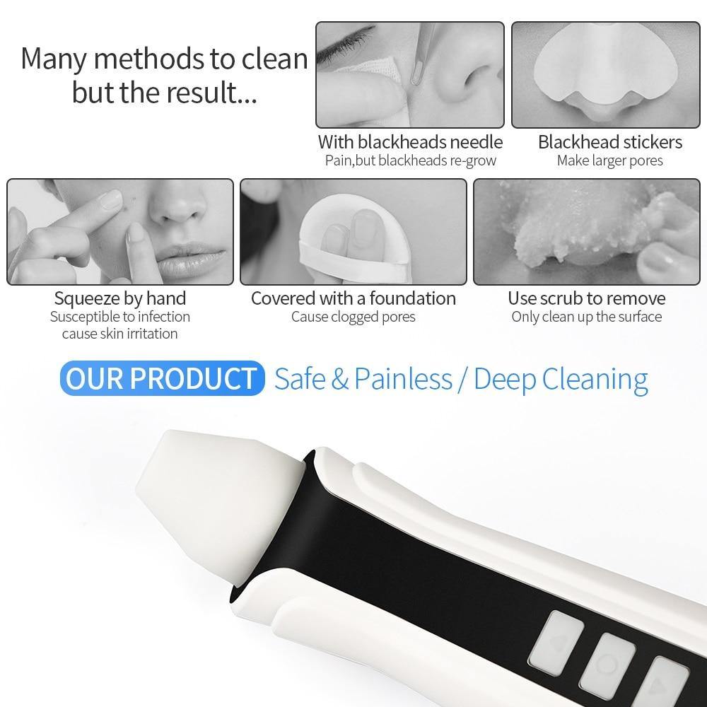 Visual Blackhead Pore Vacuum Remover Cleaner With Wifi Camera - Beautyic.co.uk