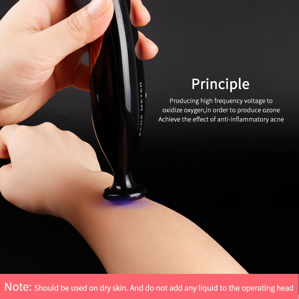 Picosecond Laser Pen Acne Meter Plasma Pen for Spots Acne Removal - Beautyic.co.uk