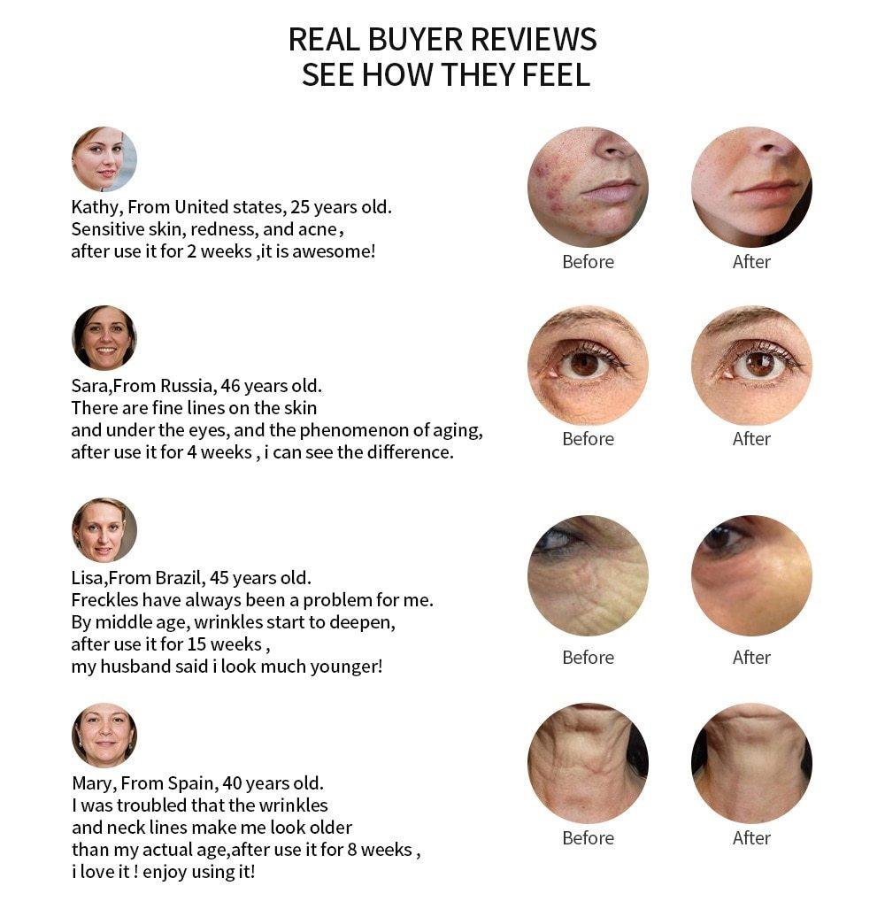 5 IN 1 LED Light Facial Therapy For Acne Wrinkle Skin Tightening Device - Beautyic.co.uk