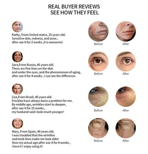 5 IN 1 LED Light Facial Therapy For Acne Wrinkle Skin Tightening Device - Beautyic.co.uk