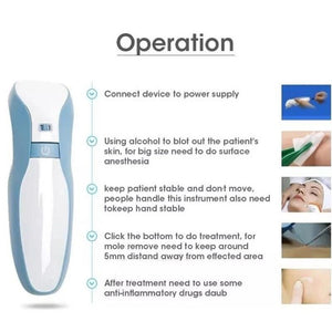 Maglev Plasma Eyelid Lifting Pen Skin Tag Mole Tattoo Removal Pen - Beautyic.co.uk