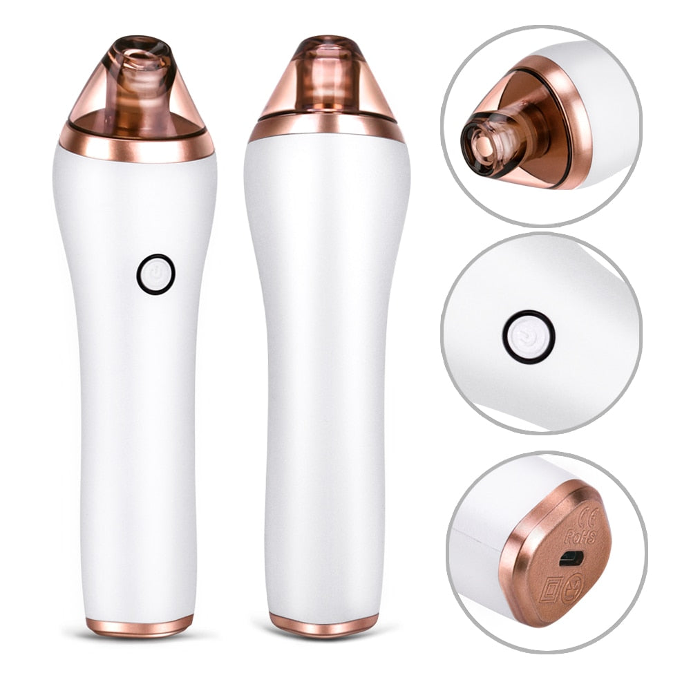Electric Cupping Guasha Acupoints Vacuum Massager Blackhead Eliminate Machine - Beautyic.co.uk