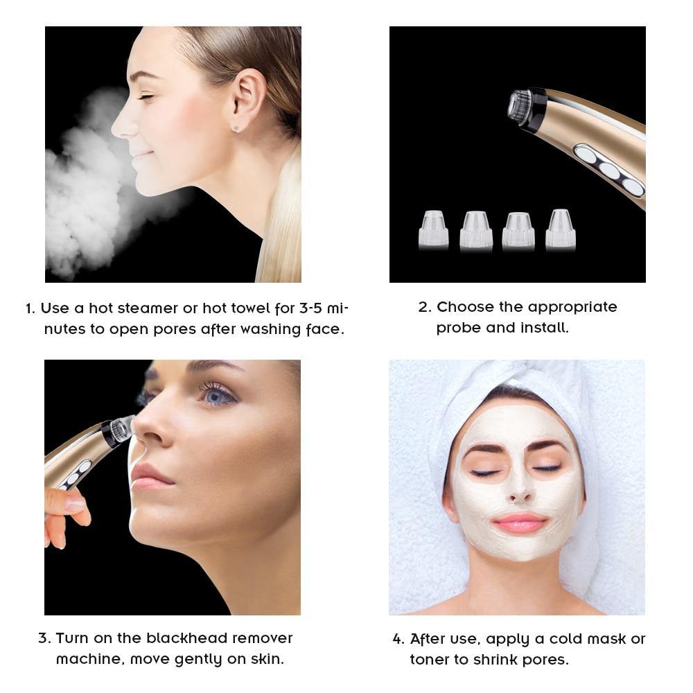 5 In 1 3D Vacuum Electric Blackhead Removal 2.0 - Beautyic.co.uk