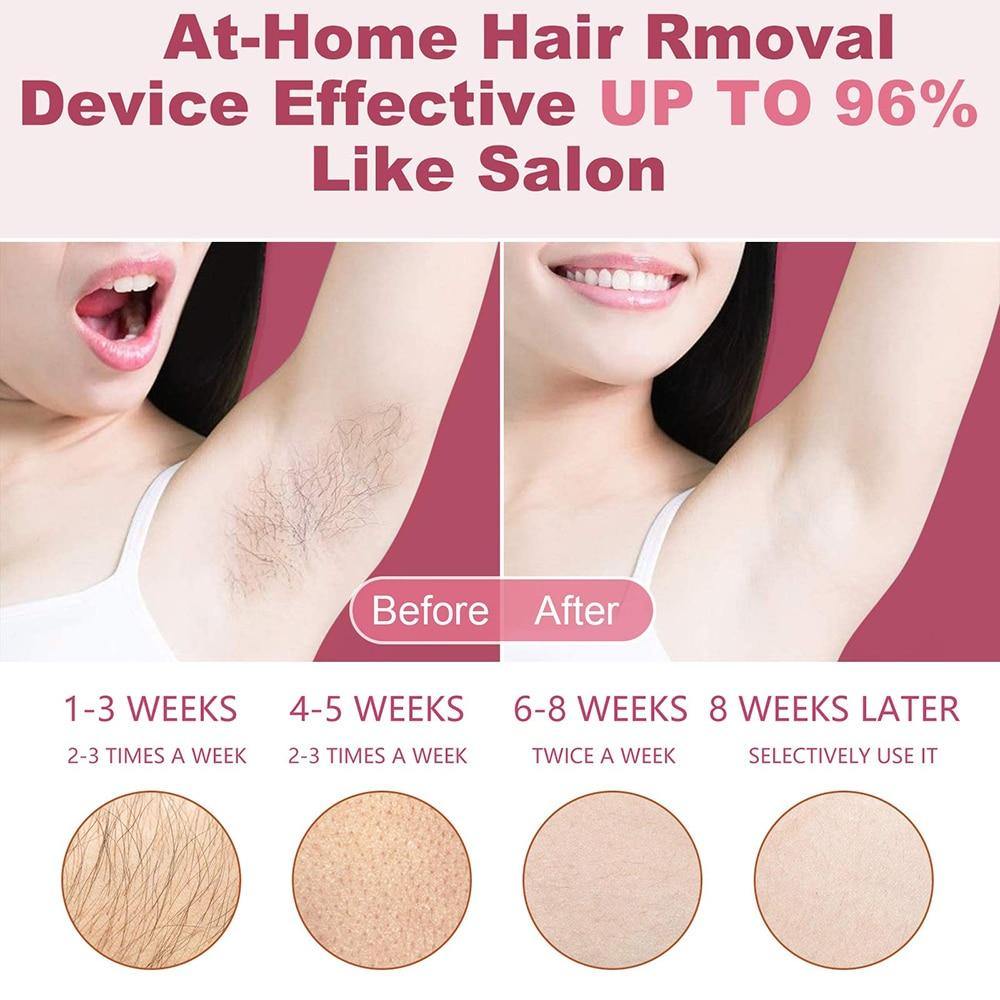 600000 Depilatory Laser Mini Hair Epilator Permanent Body Hair Remover - Beautyic.co.uk