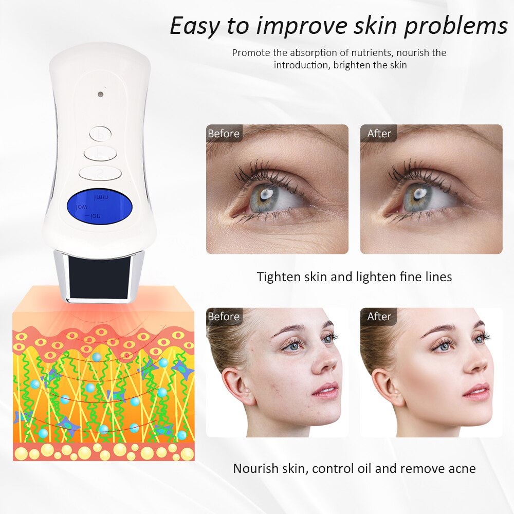Mini Microcurrent Ion Galvanic Face Spa Device with 3 Massage Heads - Beautyic.co.uk