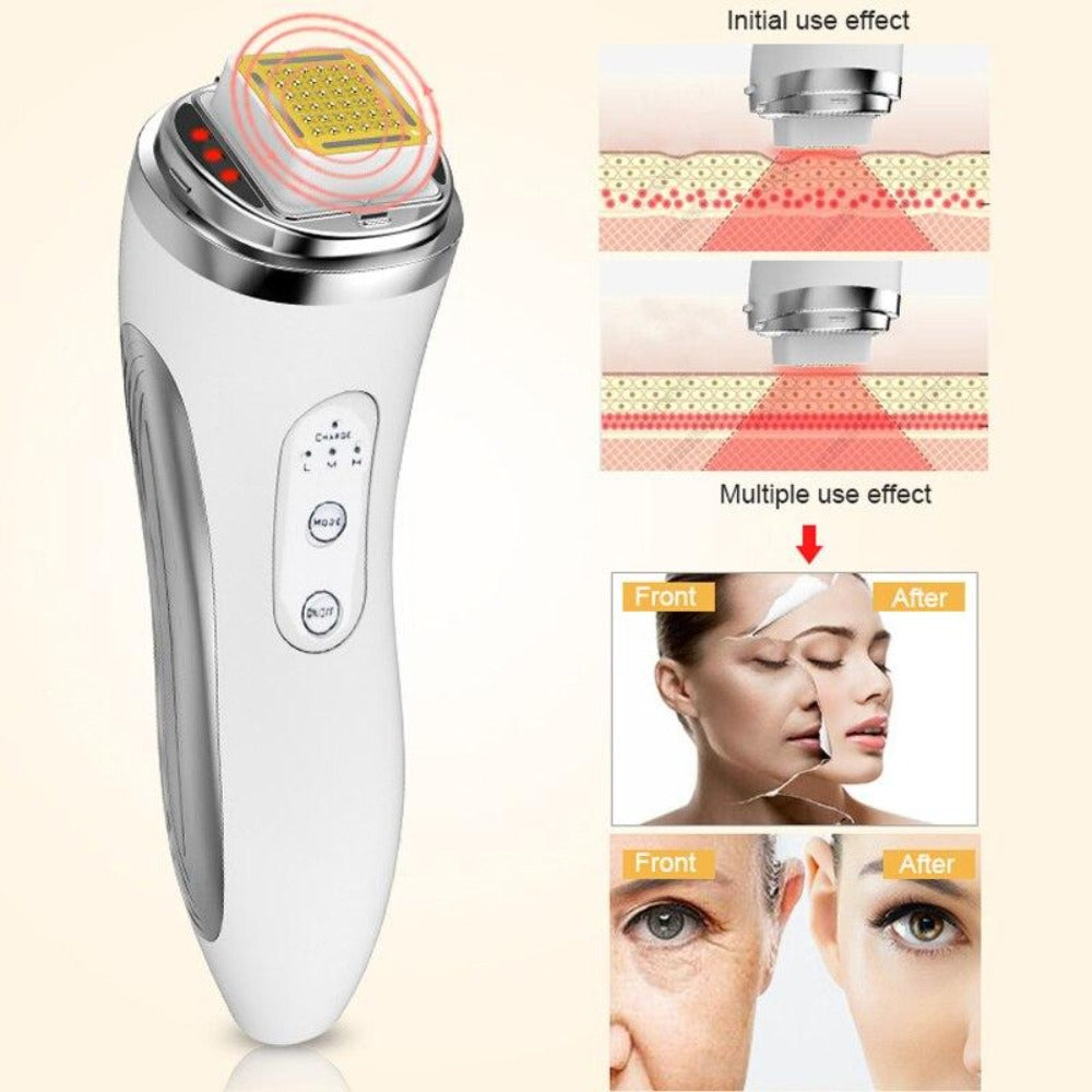 Rechargeable RF Dot Matrix Facial Skin Tightening Wrinkle Removal Beauty Machine - Beautyic.co.uk