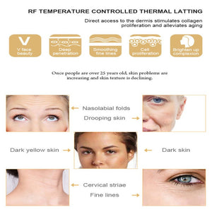 Rechargeable RF Dot Matrix Facial Skin Tightening Wrinkle Removal Beauty Machine - Beautyic.co.uk