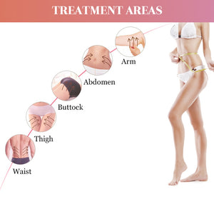 Mini HIFU Ultrasonic RF Anti Cellulite Anti Wrinkle Skin Lifting Massager - Beautyic.co.uk