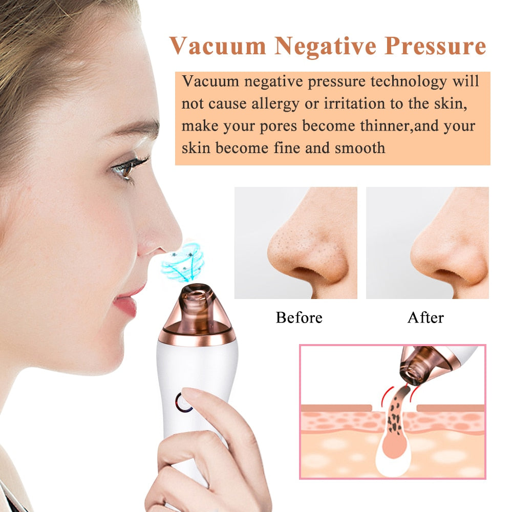 Electric Cupping Guasha Acupoints Vacuum Massager Blackhead Eliminate Machine - Beautyic.co.uk