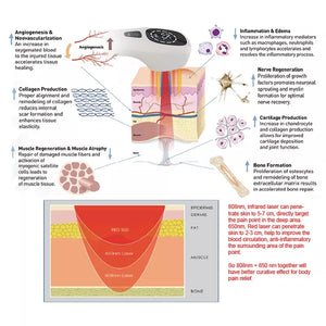 Cold Laser Therapy Device 808nm 650nm Dual Laser Pain Relief for Humans and Pets Red Light Physiotherapy LED Display Rechargeable Battery