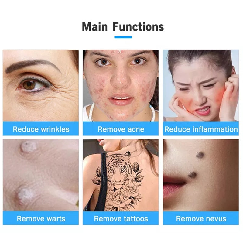 Ozone Plasma Pen Freckle Remover Machine LCD - Beautyic.co.uk