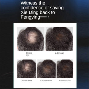 Helmet Laser Cap For Hair Growth - Beautyic.co.uk