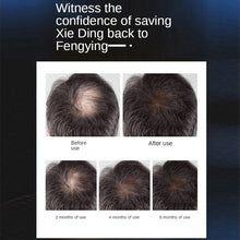 Load image into Gallery viewer, Helmet Laser Cap For Hair Growth - Beautyic.co.uk
