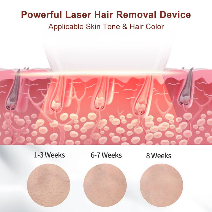 Hair Removal IPL Laser Epilator Facial Cleanser - Beautyic.co.uk