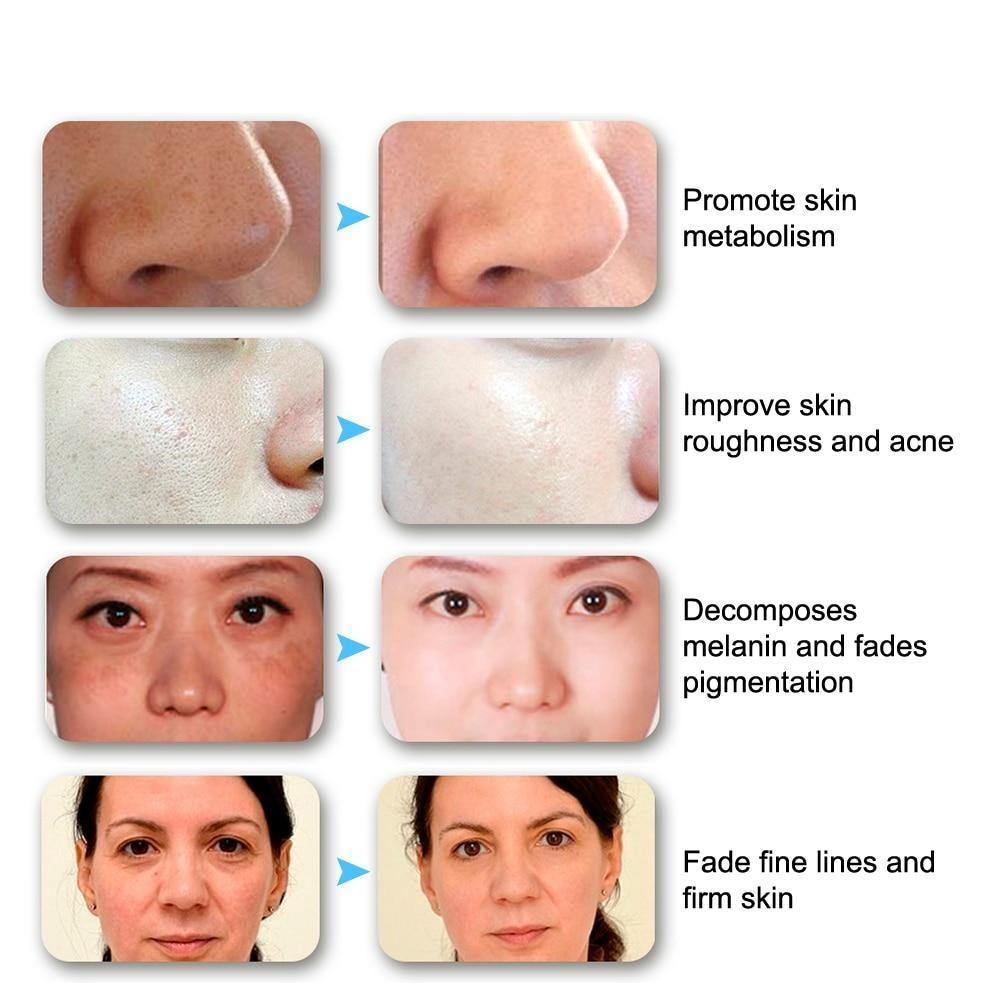 3/7 Colors Light LED Facial Mask Skin PDT Rejuvenation Home Salon Mask - Beautyic.co.uk