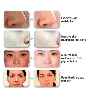 3/7 Colors Light LED Facial Mask Skin PDT Rejuvenation Home Salon Mask - Beautyic.co.uk