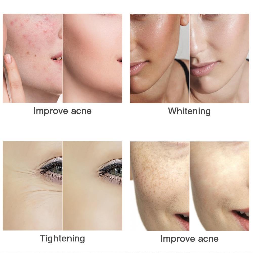 LED Light Therapy Wireless Facial Shield - Beautyic.co.uk