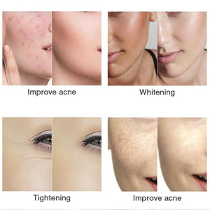 LED Light Therapy Wireless Facial Shield - Beautyic.co.uk