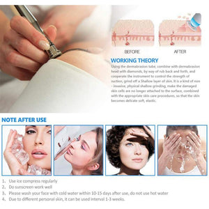 3 in 1 Diamond Microdermabrasion Machine Vacuum Spray Dermabrasion Therapy Machine - Beautyic.co.uk