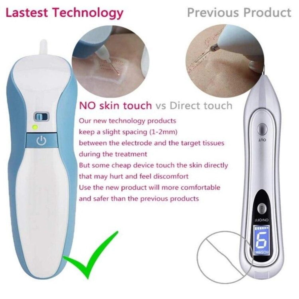Maglev Plasma Eyelid Lifting Pen Skin Tag Mole Tattoo Removal Pen - Beautyic.co.uk