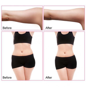 40K RF Radio Frequency Cavitation Ultrasonic Weight Loss Machine - Beautyic.co.uk