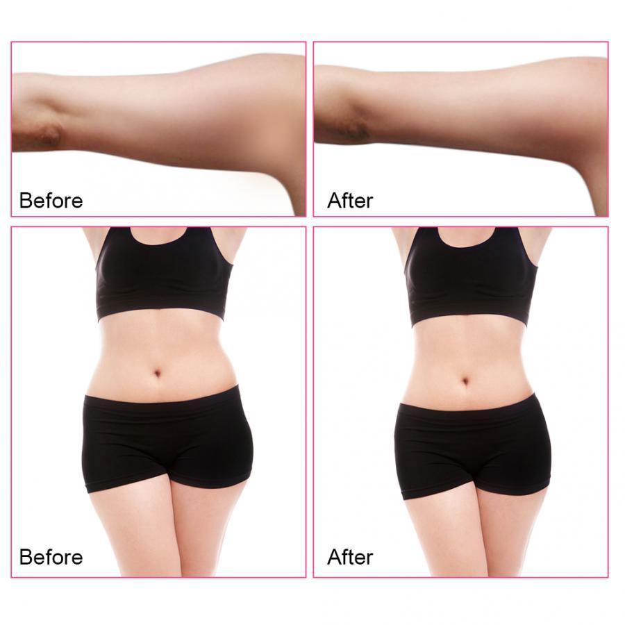 40K RF Radio Frequency Cavitation Ultrasonic Weight Loss Machine - Beautyic.co.uk