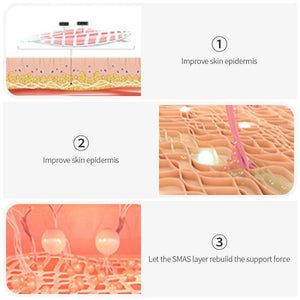 HIFU- High Intensity Focused Ultrasound Device - Beautyic.co.uk