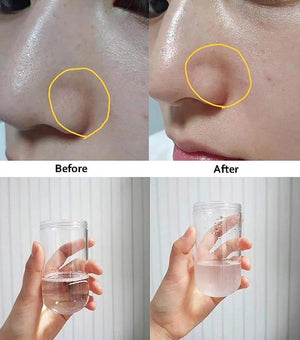 Blackhead Remover Pore Vacuum Water Oxygen Jet Beauty Machine Multifunctional Facial Suction Machine Cleaning Microdermabrasion Skin Care Instrument - Beautyic.co.uk