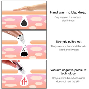 Portable Oxygen Spray Water Injection Hydro Jet Skin Rejuvenation Beauty Machine - Beautyic.co.uk