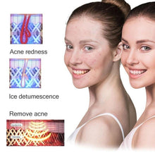 Load image into Gallery viewer, 4 in 1 Icecool IPL Permanent Laser Hair Removal  Laser Epilator - Beautyic.co.uk
