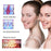 4 in 1 Icecool IPL Permanent Laser Hair Removal  Laser Epilator - Beautyic.co.uk
