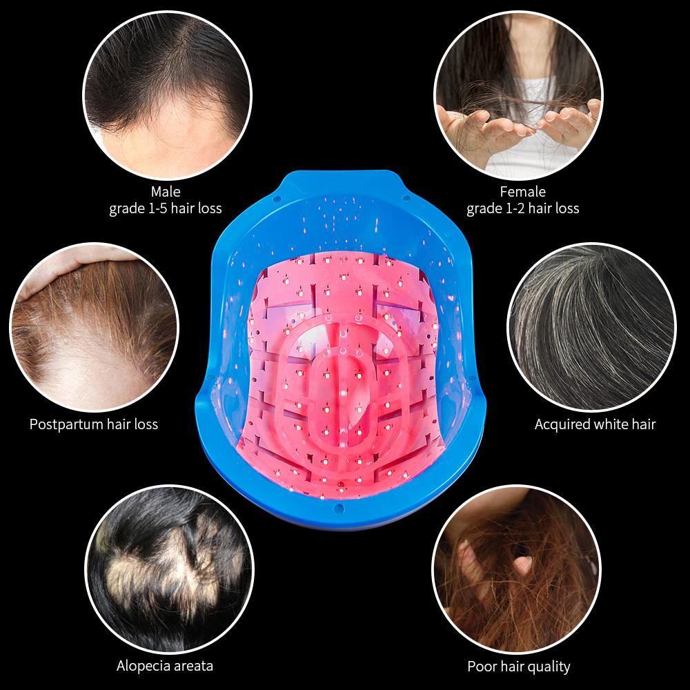 Laser Hair Growth Helmet For Hair Therapy Treatment And Regrowth System - Beautyic.co.uk