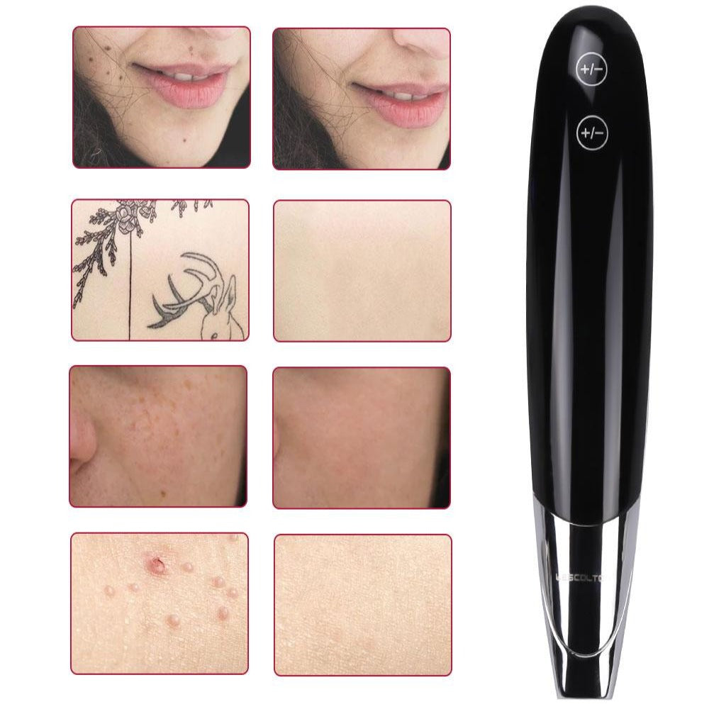 Upgrade Laser Picosecond Pen Tattoo Freckle Mole Spot Removal Pen - Beautyic.co.uk
