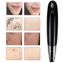 Load image into Gallery viewer, Upgrade Laser Picosecond Pen Tattoo Freckle Mole Spot Removal Pen - Beautyic.co.uk
