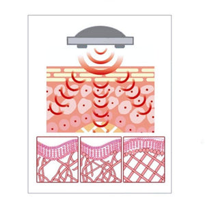4 in 1 Mini RF Microcurrent Bio LED Electroporation Face Care Device - Beautyic.co.uk