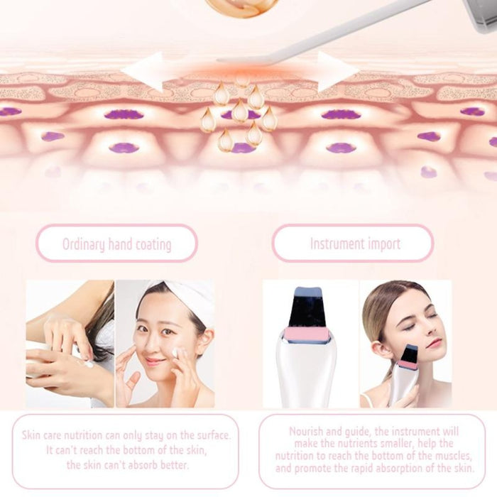 EMS & Ultrasonic Facial Peeling Scrubber Deep Cleaning Vibration Massager - Beautyic.co.uk