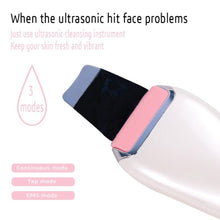 Load image into Gallery viewer, EMS &amp; Ultrasonic Facial Peeling Scrubber Deep Cleaning Vibration Massager - Beautyic.co.uk
