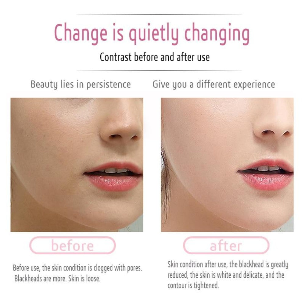 EMS & Ultrasonic Facial Peeling Scrubber Deep Cleaning Vibration Massager - Beautyic.co.uk