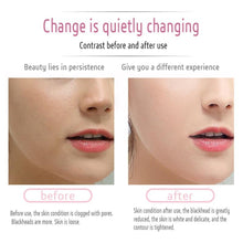 Load image into Gallery viewer, EMS &amp; Ultrasonic Facial Peeling Scrubber Deep Cleaning Vibration Massager - Beautyic.co.uk
