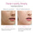 EMS & Ultrasonic Facial Peeling Scrubber Deep Cleaning Vibration Massager - Beautyic.co.uk